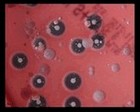 Beta and gamma hemolysis